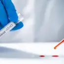 Emineo - Labor asszisztens