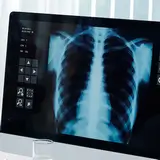 Emineo Ügyeletes Röntgen