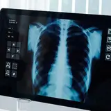 Ügyeletes Radiológus