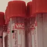 Regenero-Laborvizsgálat