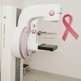 Smart Diagnosztika Lunar - Mammográfia