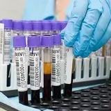 Újbuda Medical Center - Labor